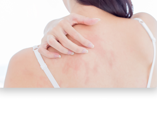 면역체계를-정상적으로-되돌리는-치료-알레르기-치료