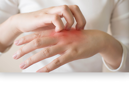 보이는-것이-다가-아닌-근본을-파악한-치료-건선-치료