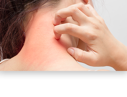 열진정을-돕고-염증-유발-요인을-찾는-치료-지루-피부염-치료