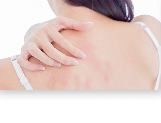 면역체계를-회복하는-근원적-치료-대상포진-치료