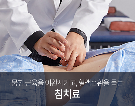 뭉친-근육을-이완시키고-혈액순환을-돕는-침치료