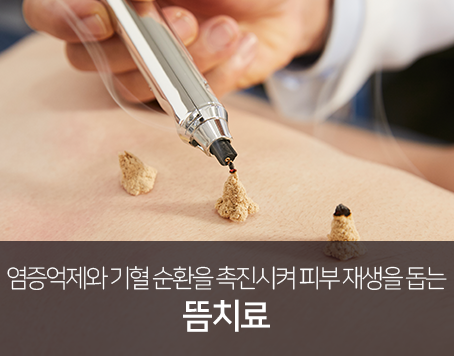 염증억제와-기혈-순환을-촉진시켜-피부-재생을-돕는-뜸치료