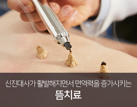 신진대사가-활발해지면서-면역력을-증가시키는-뜸치료