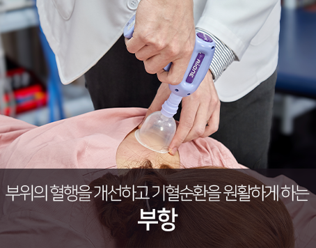 부위의-혈행을-개선하고-기혈순환을-원활하게-하는-부항