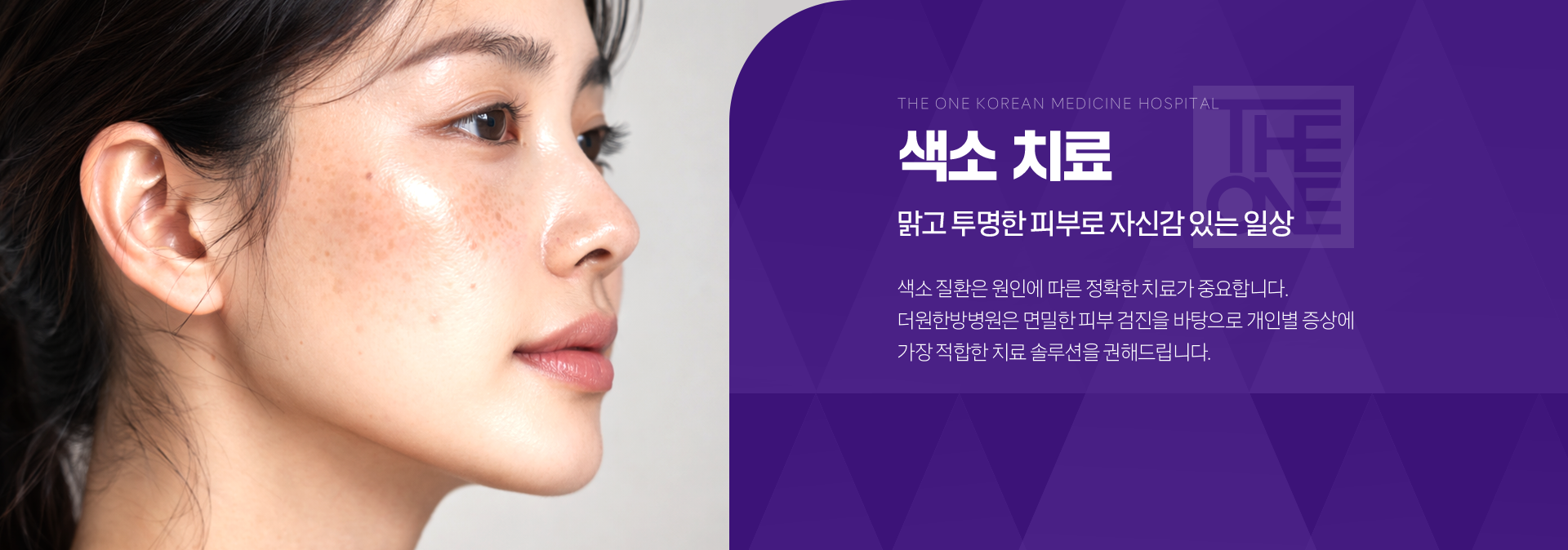 색소치료