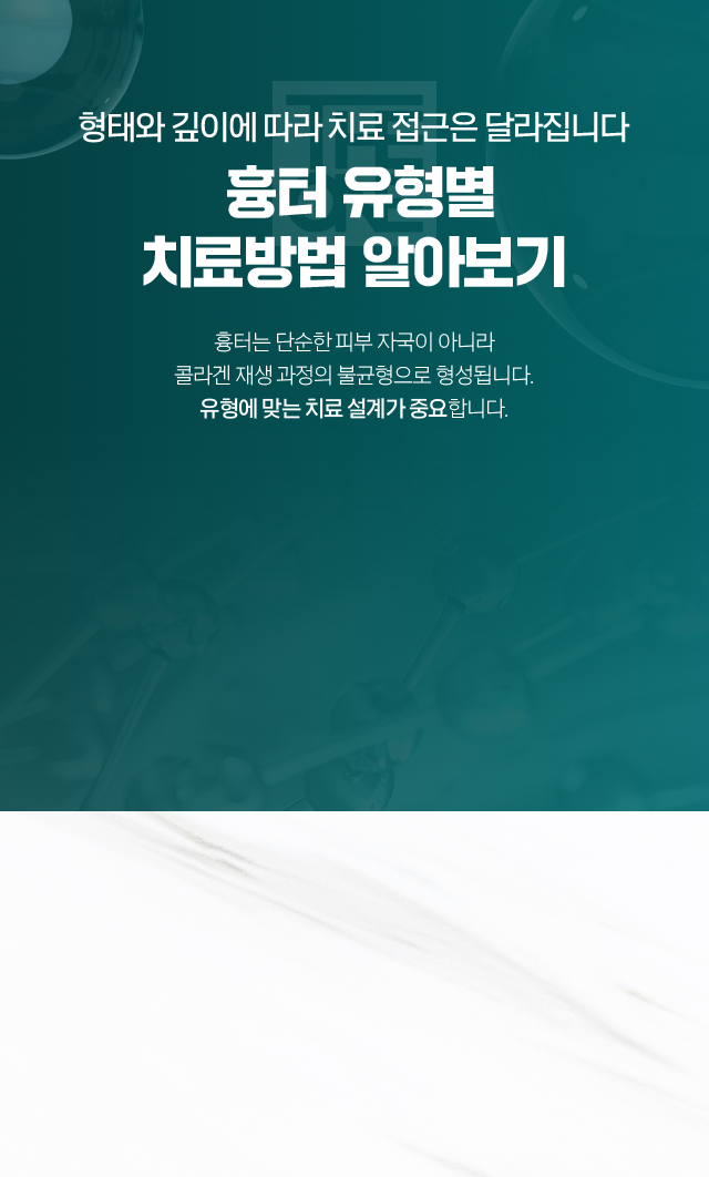 흉터 배경