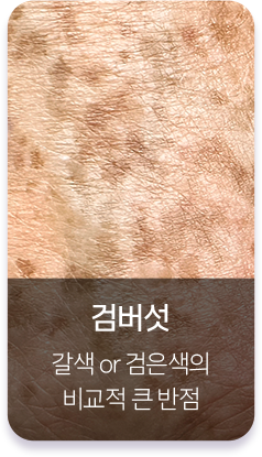 검버섯