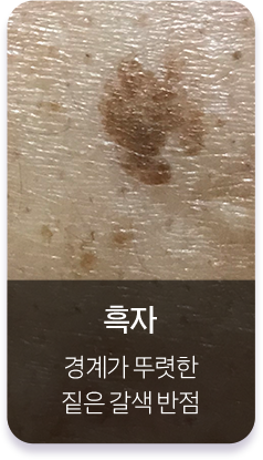 흑자