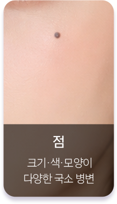 점