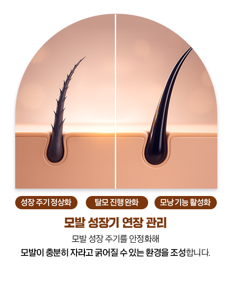 모발 성장기 연장 관리