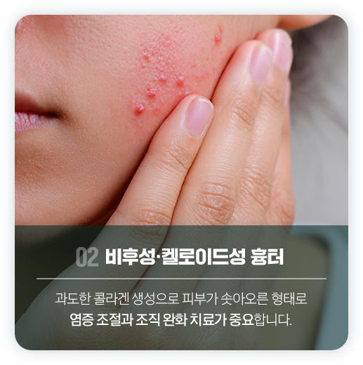 흉터치료 2